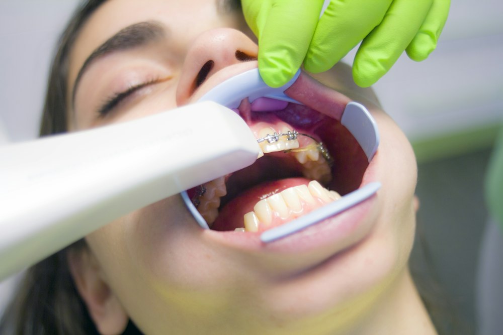 escaner intraoral
