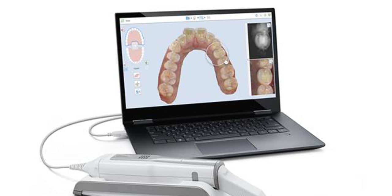 Align Technology's iTero Element 5D Imaging System Receives FDA Clearance | Orthodontic Products