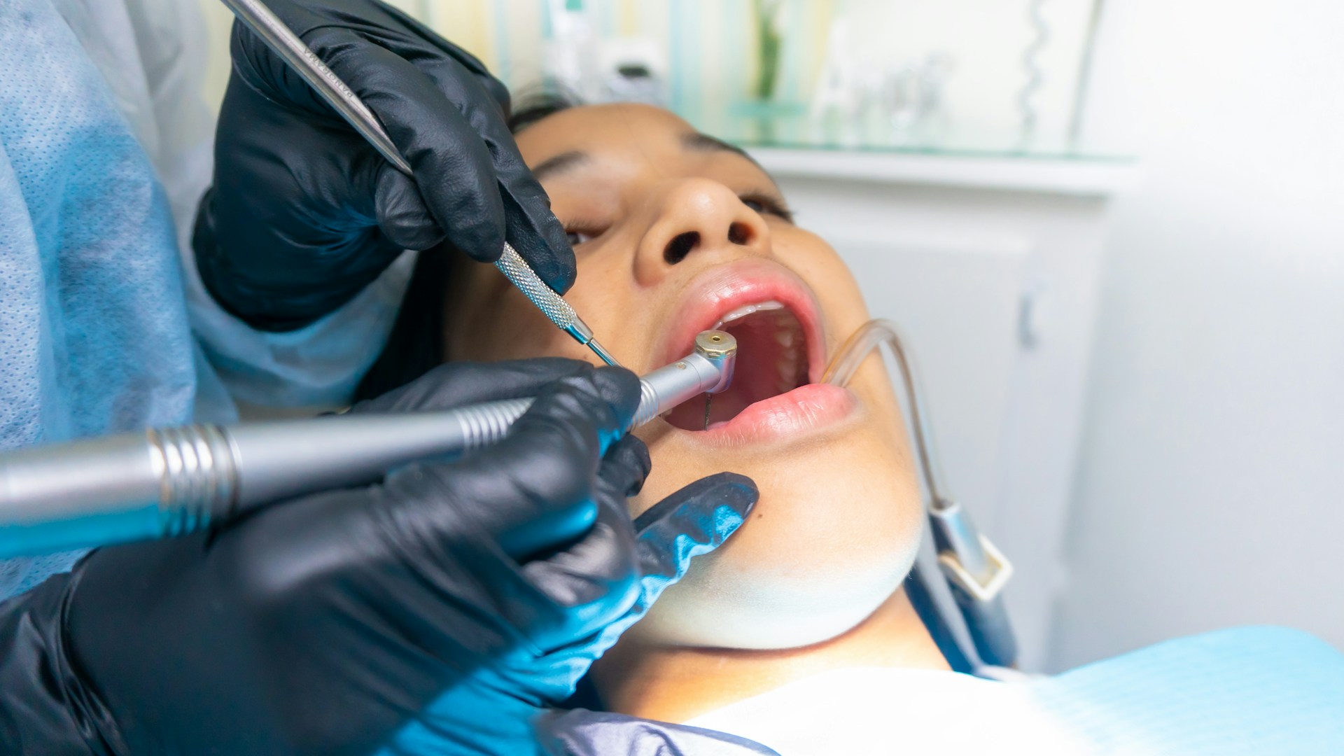 fresa dental