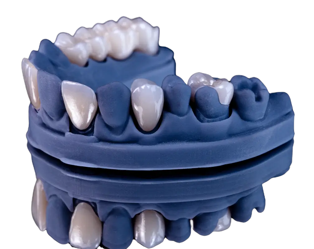 Protesis dental