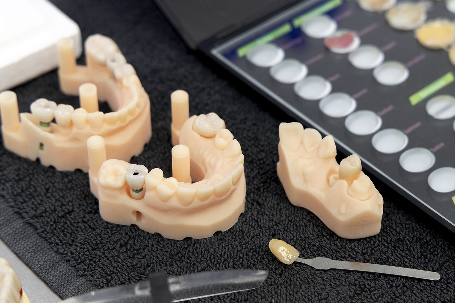 Modelos dentales con coronas y puentes terminados junto a una guía de color en el laboratorio.